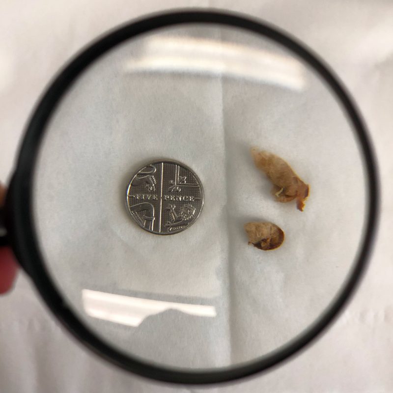 What have we ear? Leeds Audiology Clinic